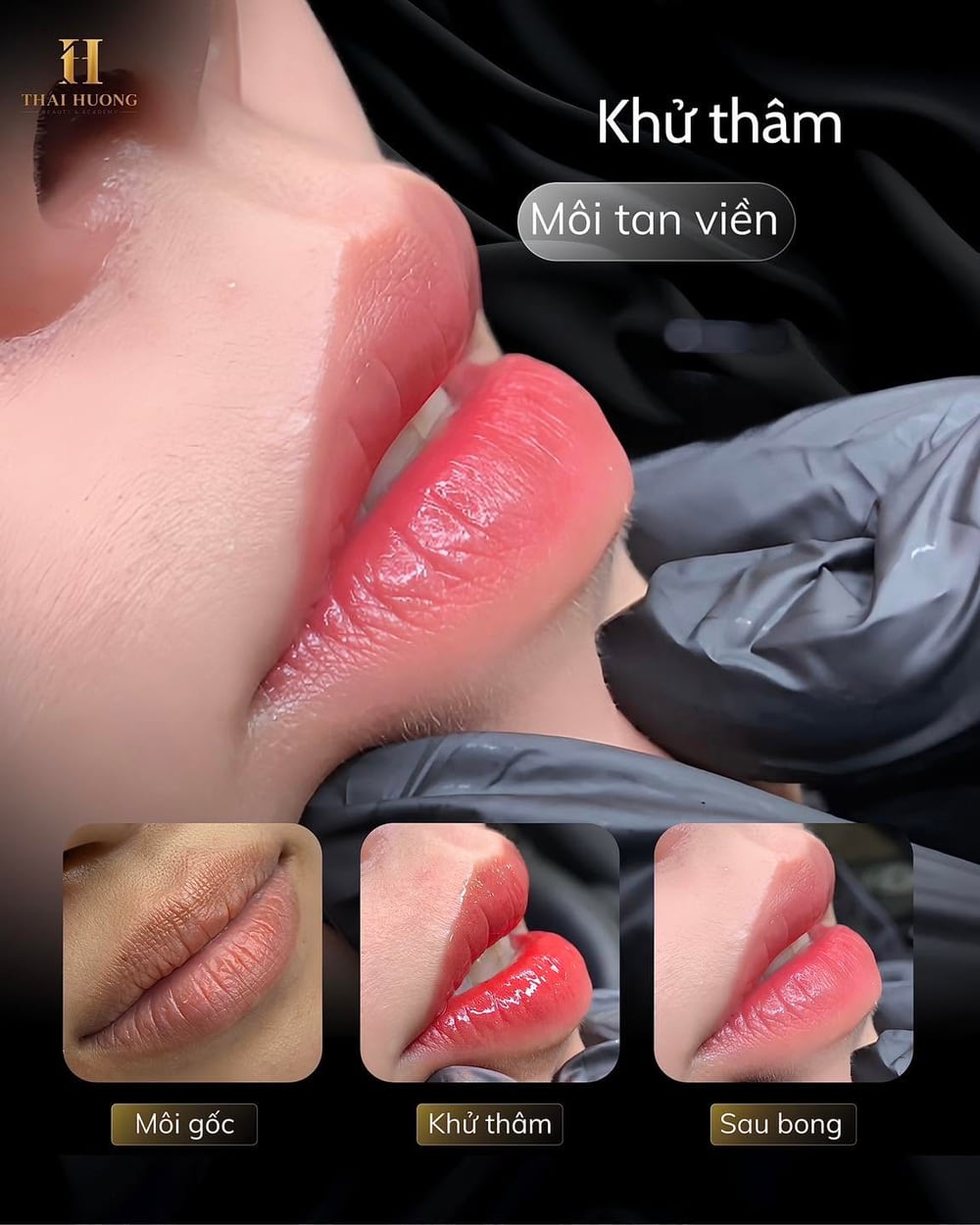 Khử thâm môi tan viền